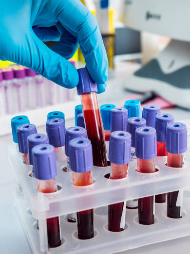 Afbeelding Bloedbuisjes